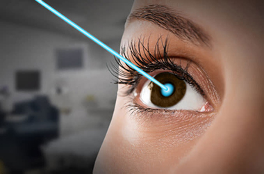 Lasik
